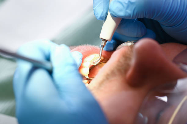 Best Urgent Care for Lost Fillings or Crowns in Lantana, FL