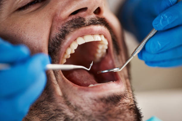 Best Emergency Dental Care for Broken or Chipped Teeth in Lantana, FL